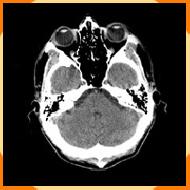Ct Scan Services