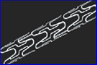 Coronary Stents