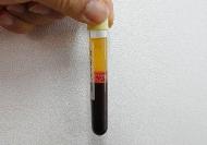 PRP Kit
