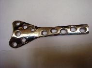 Condylar Buttress Plate