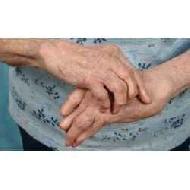 Arthritis Treatment Services